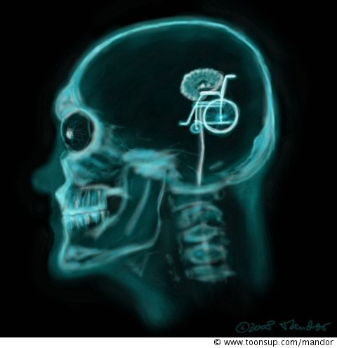 Cartoon: X-Ray 1