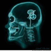 X-Ray